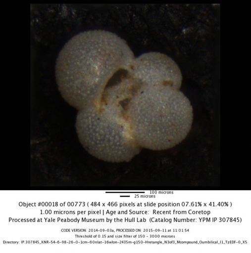undet. Foraminiferida