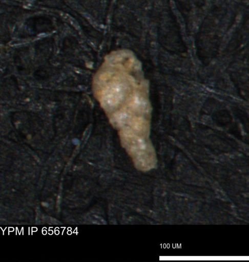 Verneuilina canadensis