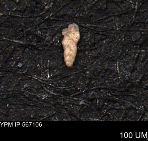 Verneuilina canadensis