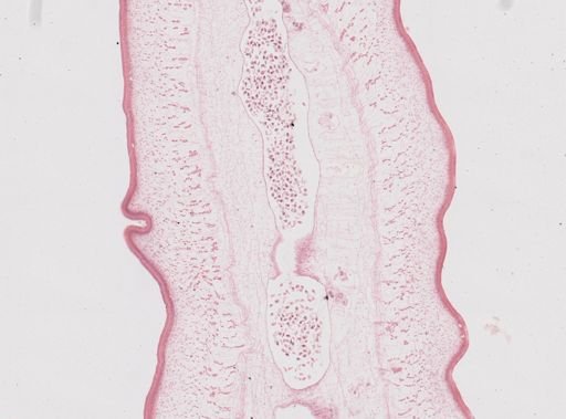 Taenia saginata