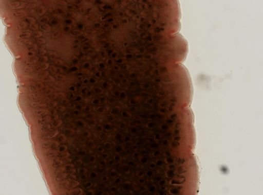Dipylidium caninum
