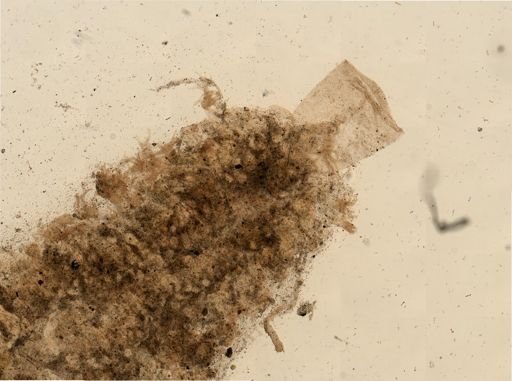 Zoobotryon verticillatum