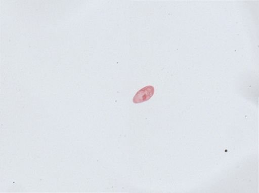 Paramecium aurelia