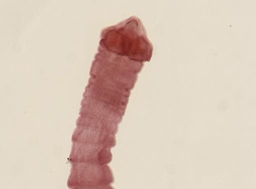 Dipylidium caninum