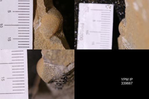 Cardium?