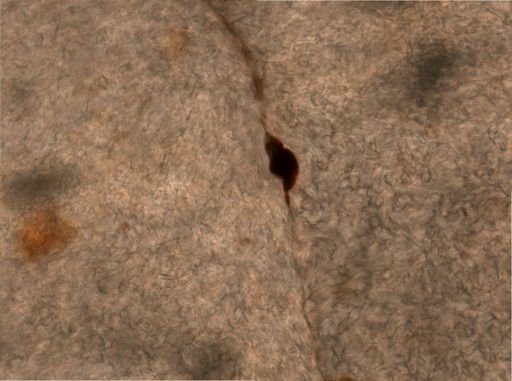 Trichocerca multicrinis