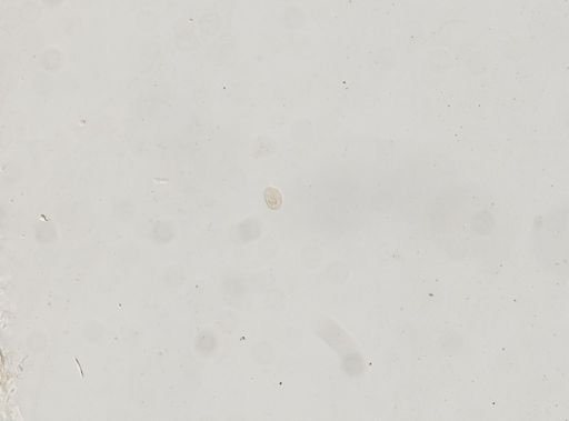Paramecium polycaryum