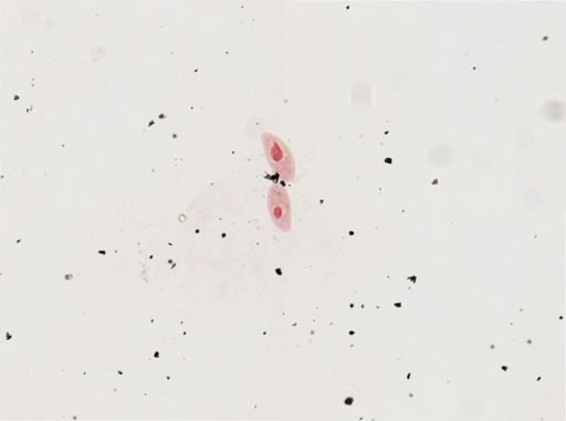Paramecium calkinsi