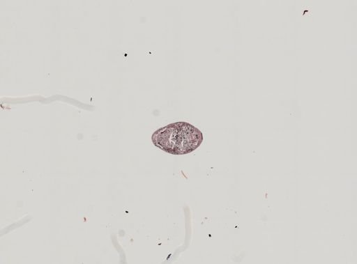 Plagiostomum whitmani