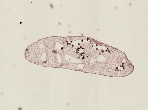 Dicrocoelium dendriticum
