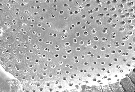 Globorotalia inflata