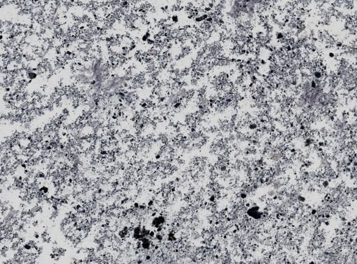 Giardia lamblia