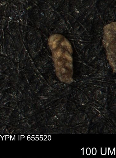 Verneuilina canadensis