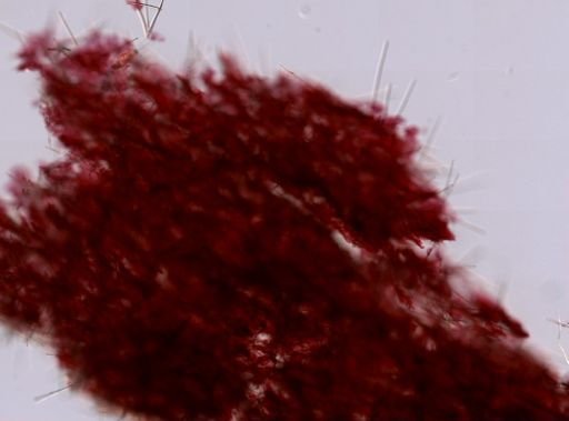Suberites sp.
