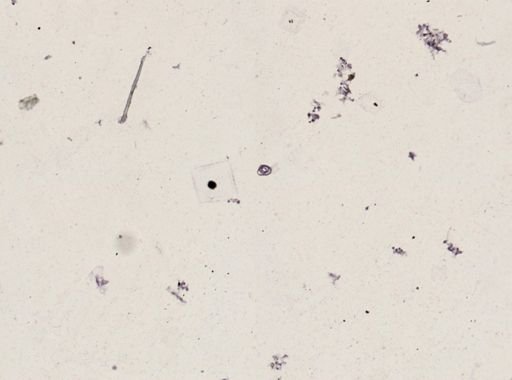 Onchocerca volvulus