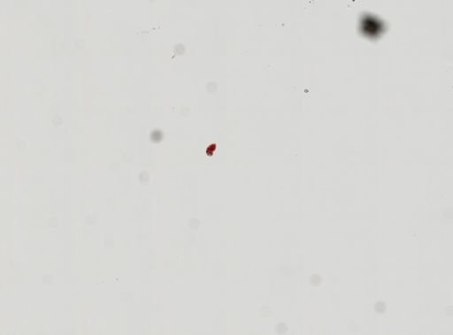 Trematoda