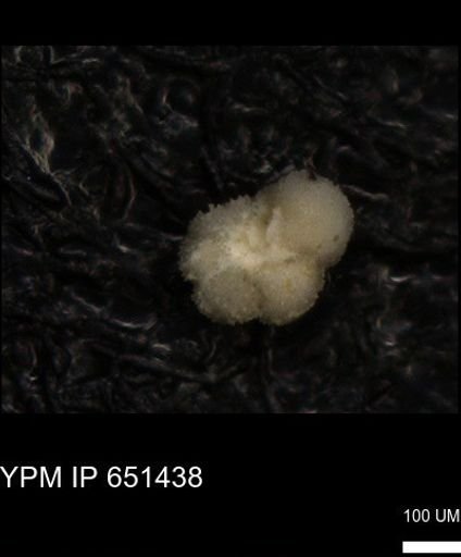 undet. Rugoglobigerinidae