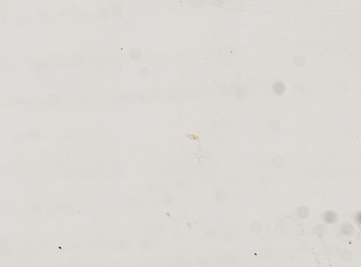 Paramecium trichium