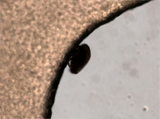 Trombidiformes