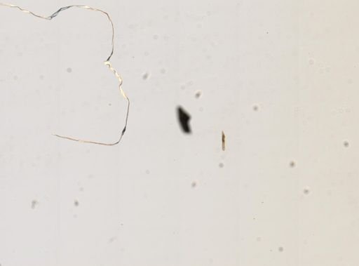Paramecium