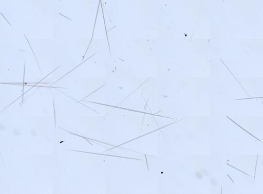 Tetilla sp.
