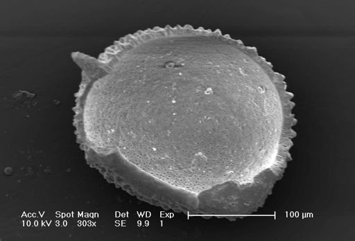 Neogloboquadrina dutertrei