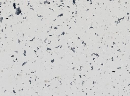 Entamoeba histolytica