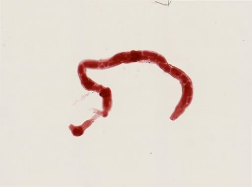 Digenea