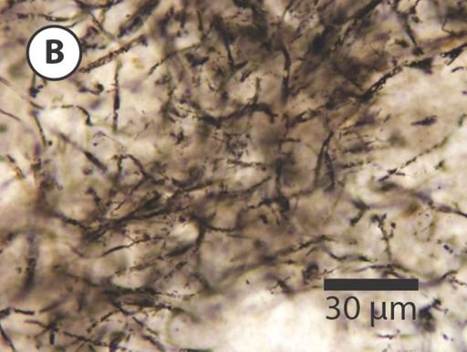 Siphonophycus
