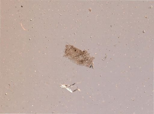 Bryozoa