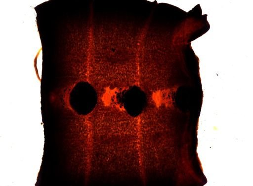 Diphyllobothrium erinacei