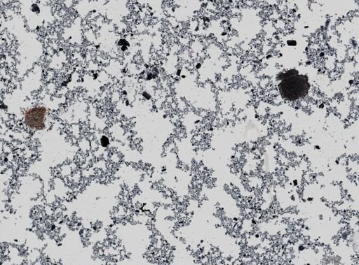 Giardia lamblia