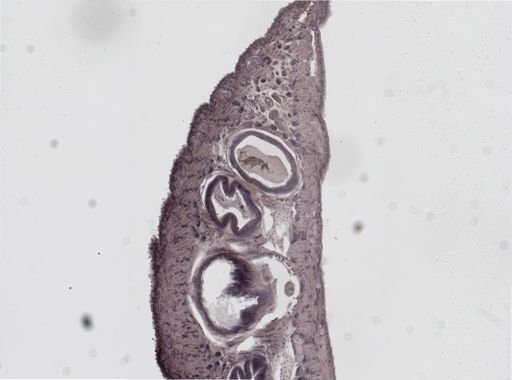 Glossiphonia