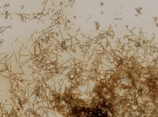 Ephydatia robusta