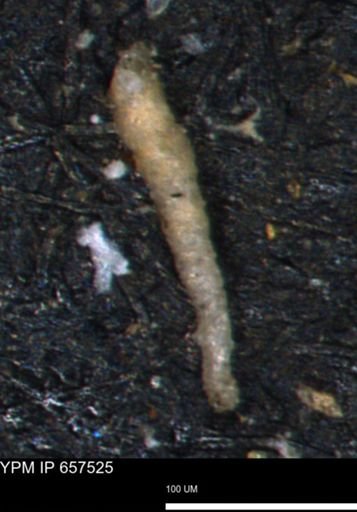 undet. Foraminiferida