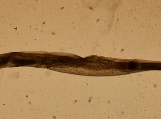 Enterobius vermicularis