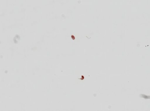 Trematoda