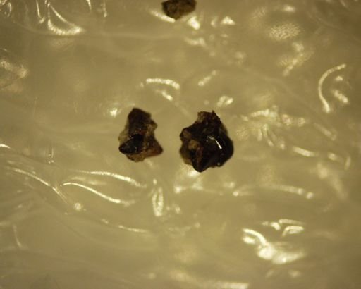 Diacocherus minutus