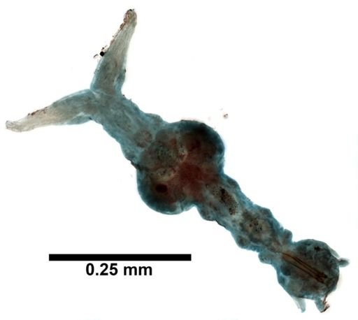 Histriobdella homari