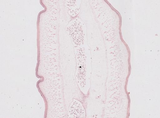 Taenia saginata