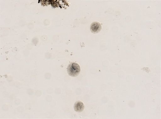 Vorticella