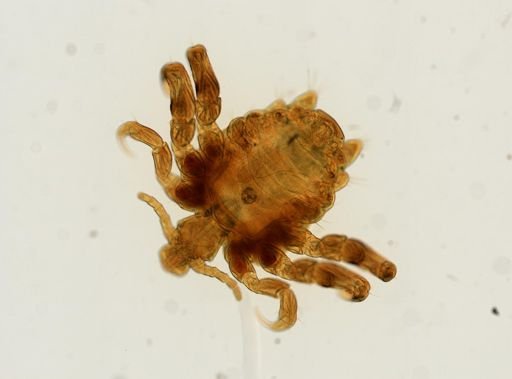 Pthirus pubis