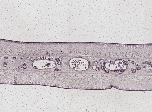 Taenia saginata