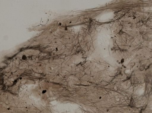 Myrmekioderma granulatum