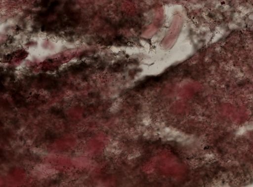 Haliclona