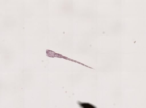 Hyalella cf. azteca
