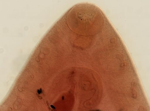 Fasciola hepatica
