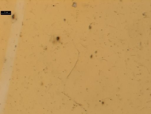 Diatoms