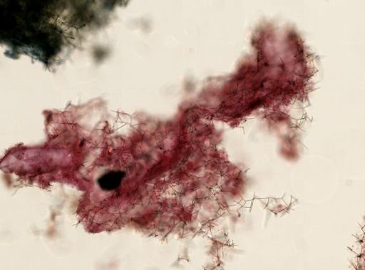 Haliclona sp.