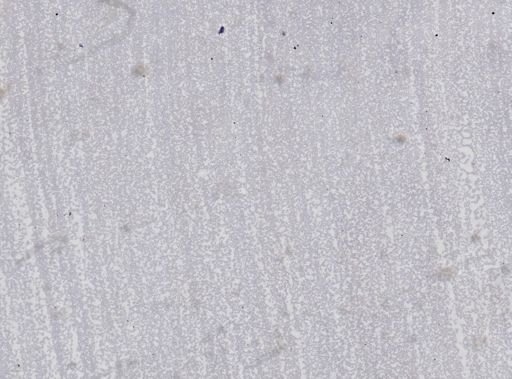 Trypanosoma equiperdum